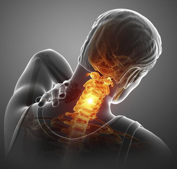 Stel i nacken? Orsaker, symptom och 6 sätt att bli av med det - Stabil Posture
